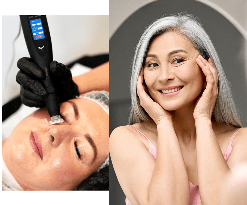 Ad for CoolJet treatments